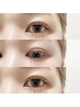 ロリー(Lolly.)/◇ Soda highlight ◇