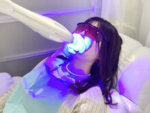 ティンクル(TWINKLE)/セルフホワイトニング施術手順12