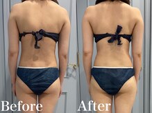 ベルクーレ(Belle cure)/ウエストもすっきり！