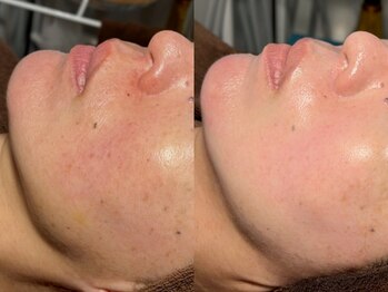 ルーナジェーナ(Luna llena)/池袋 エステ ルーナジェーナ