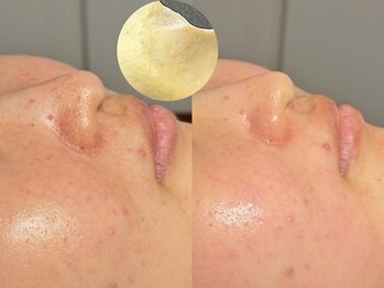 ルーナジェーナ(Luna llena)/池袋 エステ ルーナジェーナ