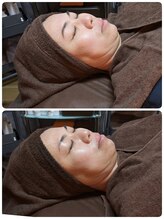 ウララ(ulala)/セラピールビフォアフ