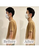 アマテル(AMATERU)/Before/After4