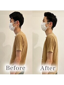 アマテル(AMATERU)/Before/After4