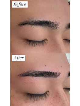 ビュー テンジン 天神 大名(VIEW TENJIN)/アイブロウ（眉毛）ワックス脱毛