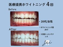 セイ(sei)/症例写真　ビフォーアフター