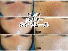 サロン エム(Salon M)の雰囲気(韓国最先端ダクトピールがすごい!!肌が変わる!!)