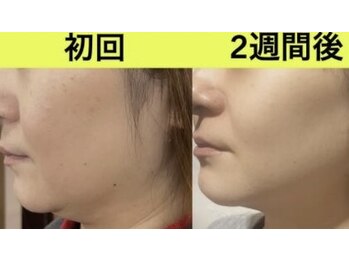 ミナミナ(MINA MINA)/レモンボトル 小顔