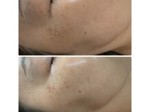 武蔵小杉リンパサロン かおりの部屋/光フォトでエイジング悩み改善