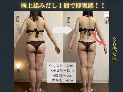 エソール(essor)の写真