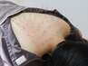 【初回限定/人気No.1】オーダーメイド鍼施術 60分 ¥20,000→¥14,000