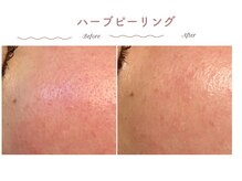 エステティックサロン シーズ/敏感・ゆらぎ肌改善