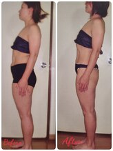 ダイエットルーム リ ボーヌ(Re Bornu)/・40代　全身メディセル16回