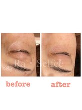 ラ セルフィー(Ra Selfee)/目元ケア♪