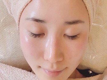 ユー(Yu)の写真/リピート率No.1☆天然美容成分でできたマツヤニを使用した美肌になれる艶肌wax！透明感＆ハリツヤ弾力UP♪