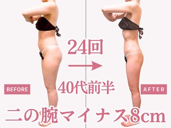 べモーレ 上本町 谷町九丁目(Bemolle)/40代痩身24回ビフォーアフター☆