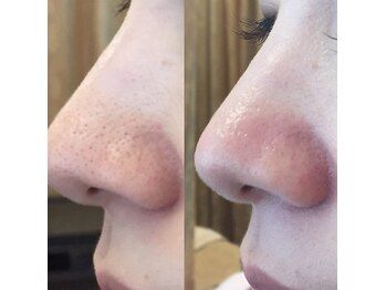 シェノン(CHAINON)