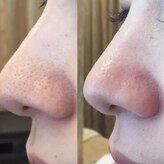 シェノン(CHAINON)