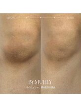 サロンドプレマージュ(Salon de Premage)/バイミュリービフォーアフター