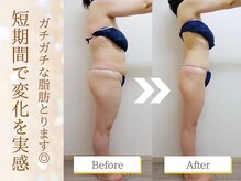 グレースフル