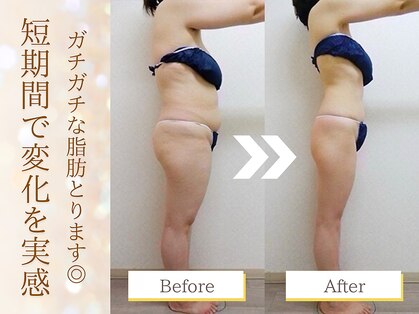 グレースフルの写真