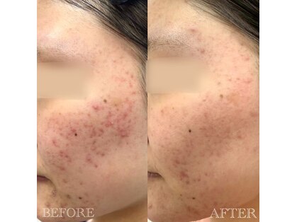 アスポーテ(ASBEAUTE)の写真