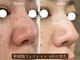 サロン アイプラス(salon i plus)の写真/くすみを改善し、お肌のトーンアップ、ハリ艶をもたらせ、透明感のあるお肌へと導きます。
