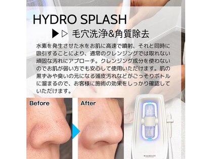 ヨノ(Yono)の写真