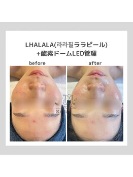 ポムハヌル(pom.haneul)/韓国肌管理室