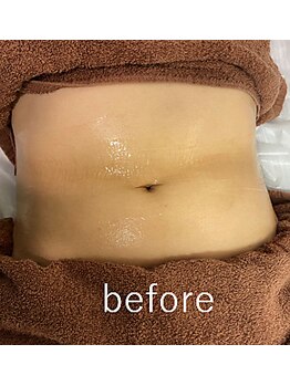 カナウ(kanau)/トリプルボディシェイプ