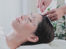 アーチ(Arch)/食いしばり・眼精疲労・肩こり