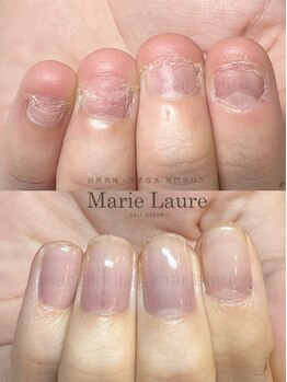 マリーロール 天王寺店(Marie Laure)/深爪改善/自爪育成/ネイルケア