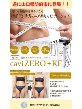 ルミネ(Lumine)/NEW caviZERO+RF デビュー！！