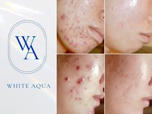 ホワイトアクア 岐阜店(WHITE AQUA)