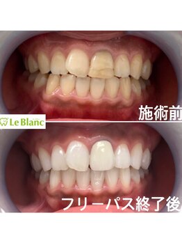 ルブラン 奈良店(Le Blanc)/相手に不快を与えないよう...
