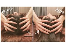 アプリフト(Uplift)/★Before★After