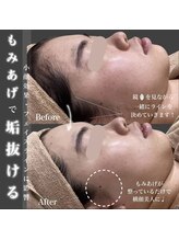 エステティック レイビス 八戸店(RAYVIS)/横顔美人に♪