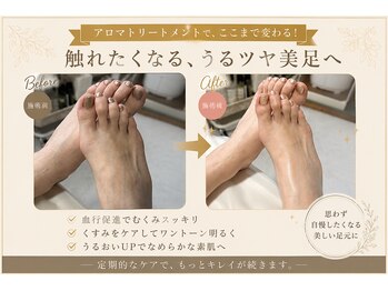ハンナ(HanNa)/フットケア|症例写真