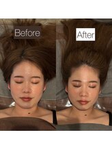 東京デトックス/インディバ小顔頭蓋骨調整60分