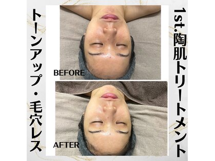 キラリ(Kirari)の写真
