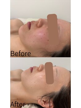 シーズ ザ デイ 熊本店(Seize the day)/艶肌ララピール☆