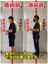 うるま整体院/before→after