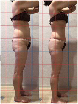 エステティックサロン フェアリー(ESTHETIC SALON FAIRLY)/痩身＝脂肪分解×セルゼロ×燃焼