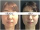 リフェイス(Re:face)の写真