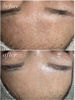 スパークル/くすみ/角質除去/トーンアップ