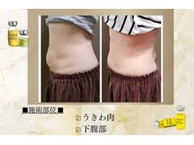 ブレア(Blair)/痩身