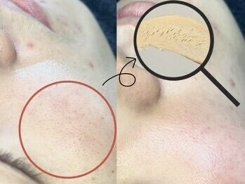 ハリウッドブロウリフト ワクシー 青山店(HOLLYWOOD BROW LIFT WAXYYY.)/FACE WAX for MEN