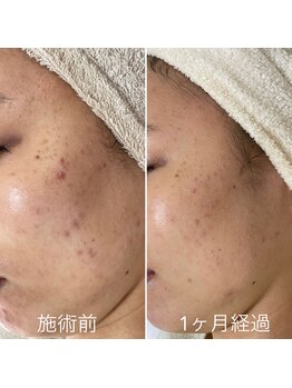 シェノン 赤坂大濠店/