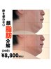 【集中顔の脂肪ケア】針を使わない顔の脂肪分解　¥8,800