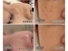 美顔アンドリラクゼーションルーム ソワン沙季